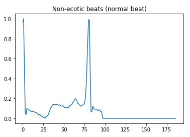 Non-ecotic beats