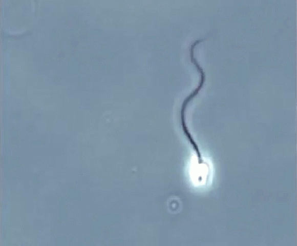 Sperm Spiralling To The Egg Health And Disease Medium
