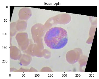 Image of a Eosinophil — a type of White blood cell