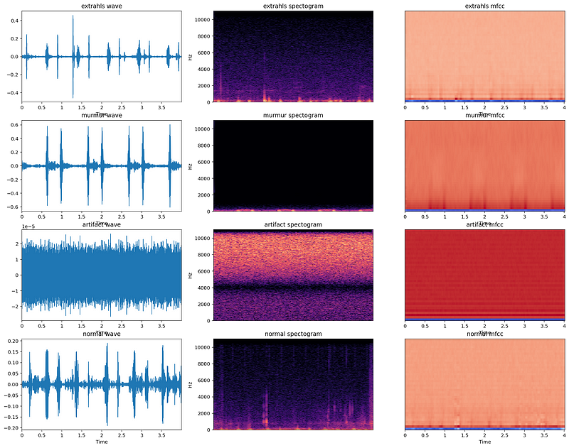 Mel-Frequency cepstrums, Mel Spectograms