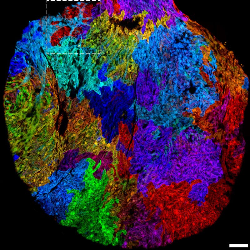 I Built a Pipeline That Finds Cell Types Your RNA-seq Can’t See