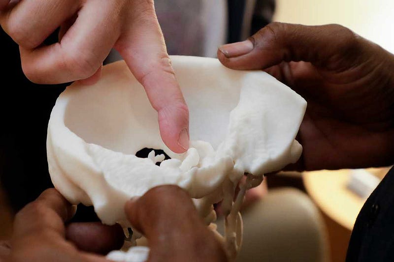 neurosurgery 3D printed model aneurysm surgery