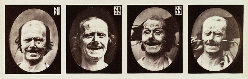 Four images showing a male having his face stimulated by electricity in an experiment on the electro-physiological expression of passions.