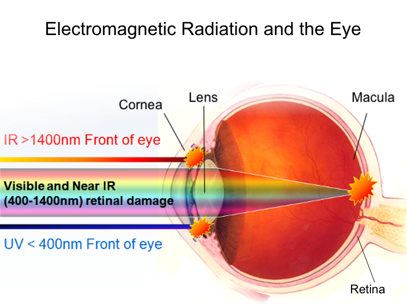 7 Things You Can do Right Now to Protect Your Vision