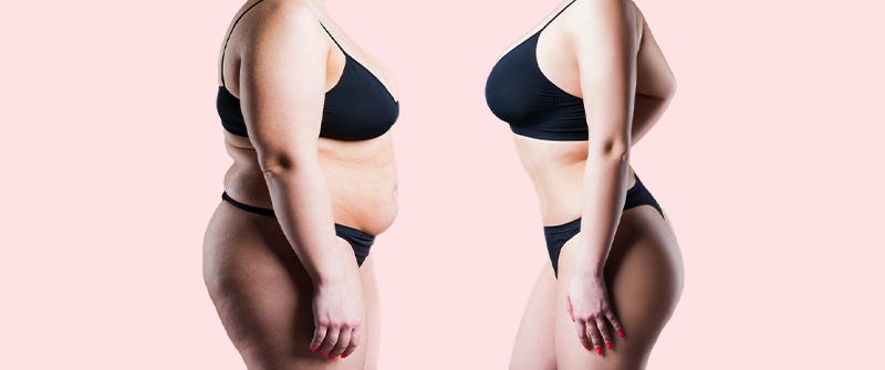 Liposuction Surgery