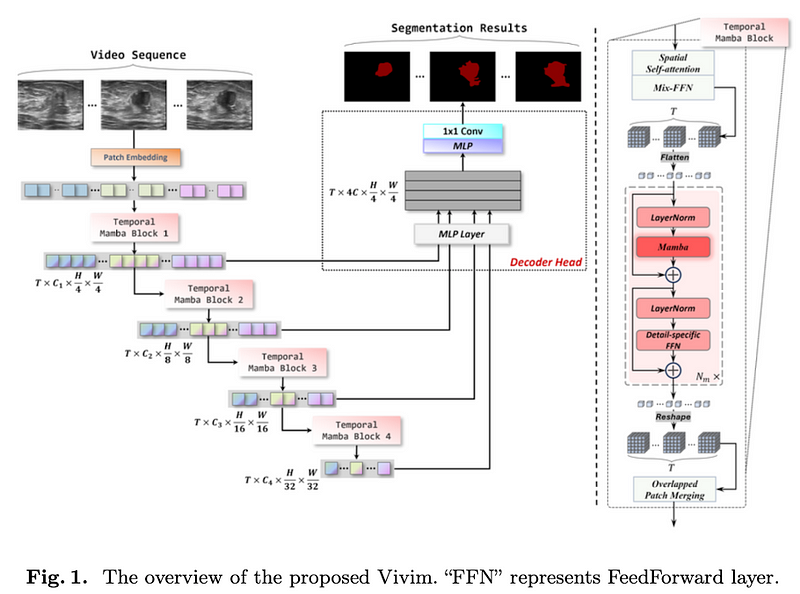 Vivim: a Video Vision Mamba for Medical Video Object Segmentation