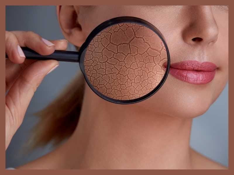 Sun damaged skin