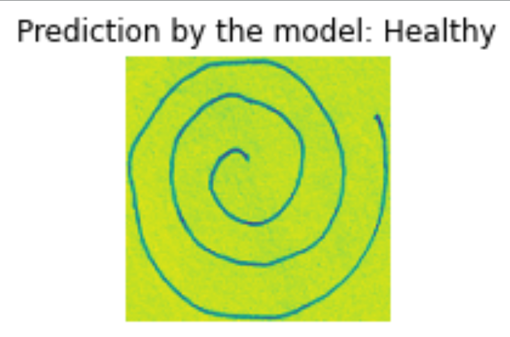 Prediction by model