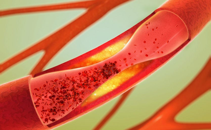 Cholesterol is not bad for us until and unless it is present in the right amount.