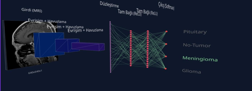 Brain Tumor Segmentation YOLO | High Accuracy