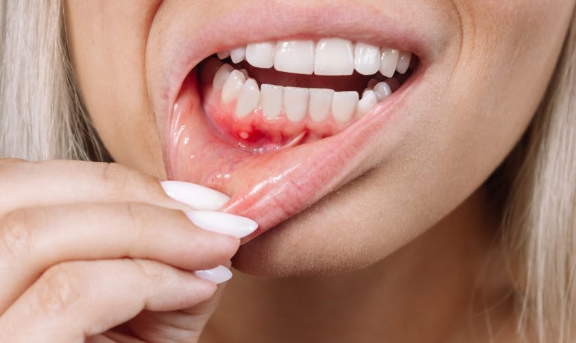 5 ways to prevent gum disease