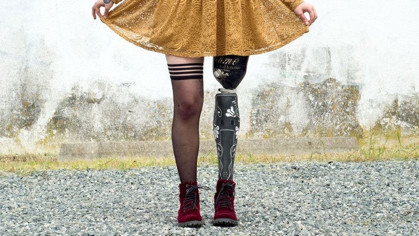 Mulher branca, segurando uma saia amarela. Usando meia 7\8 em uma perna. A outra perna é uma prótese estilisada. Calçando tênis vermelhos
