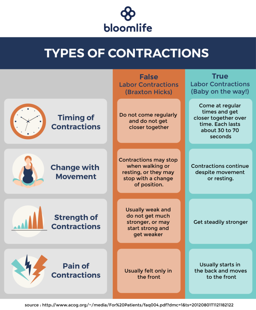 table demonstrating false labor contractions vs. real labor contractions