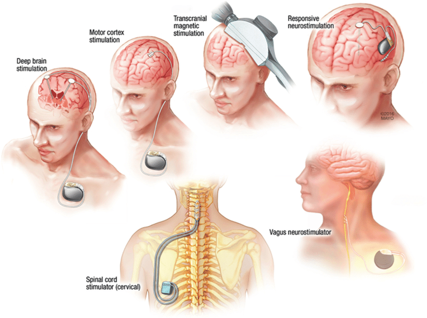 The Future of Neural Technologies: A Technical and Architectural Overview