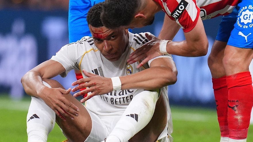 Insiden Kylian Mbappe disikut lawan dalam laga Real Madrid vs Girona di Santiago Bernabeu, 11 April 2026 © AP Photo/Manu Fernandez