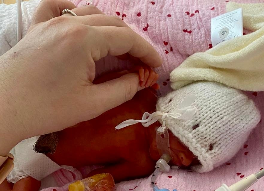 24 week premature baby gripping mother’s thumb in an incubator