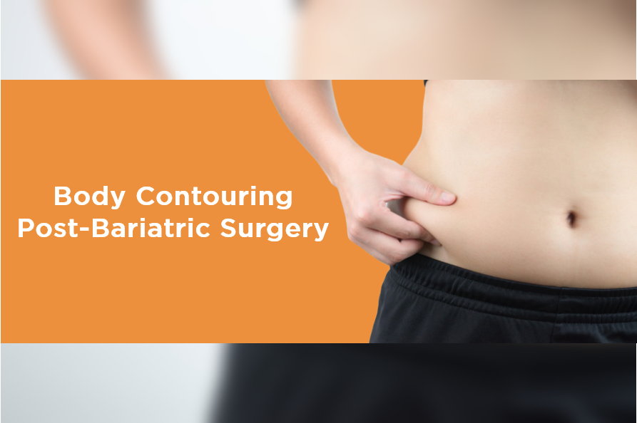 Body Contouring After Bariatric Surgery