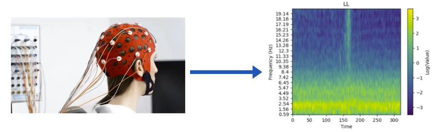 Typical EEG test, which produces a spectrogram image.