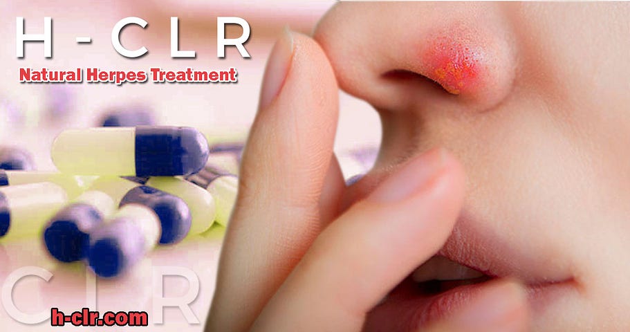 Symptoms of Herpes and Treatment.