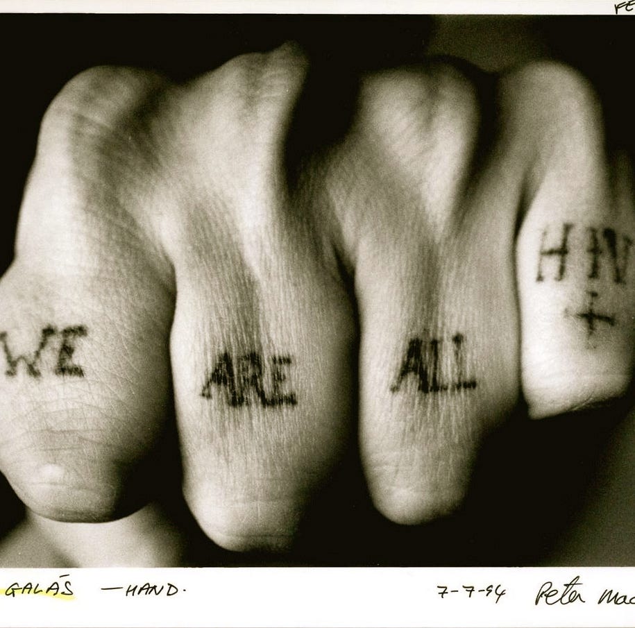 Photograph of knuckle tattoos reading “WE ARE ALL HIV+”