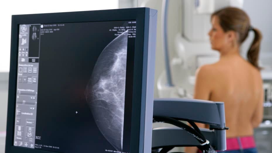 An image of a woman undergoing a mammogram exam