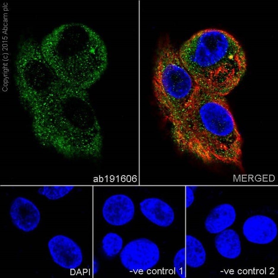 Affinity-bioscience-akt-signalling-pathway