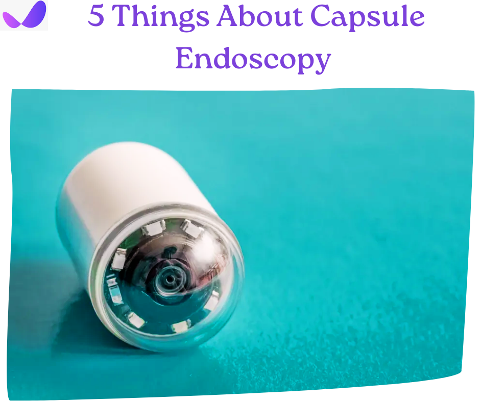 capsule endoscopy