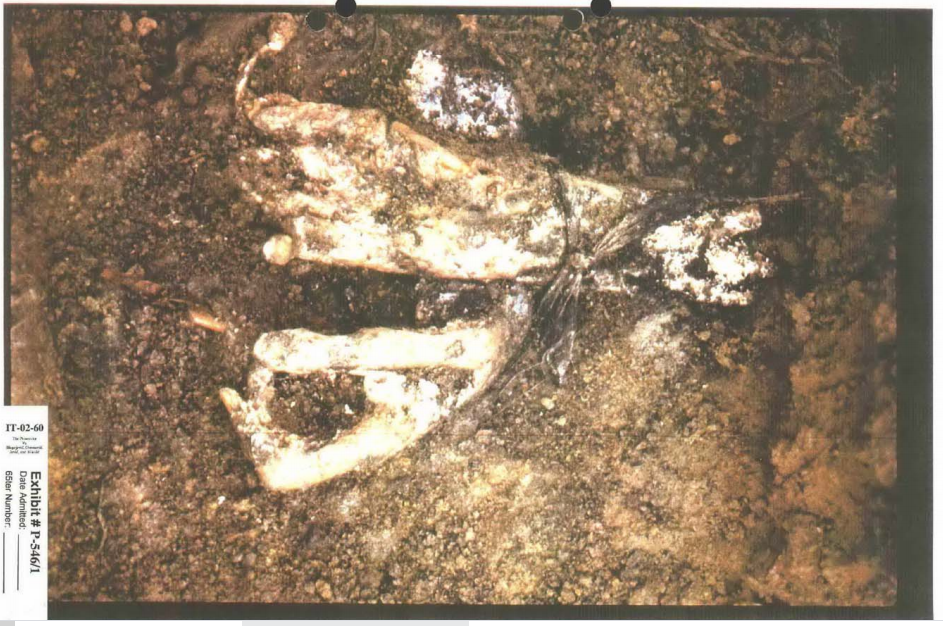 The ligatured hands of a Branjevo victim, from the exhumation at the site. Exhibit P-546/1, Prosecutor v. Blagojević ‘ Jokić.