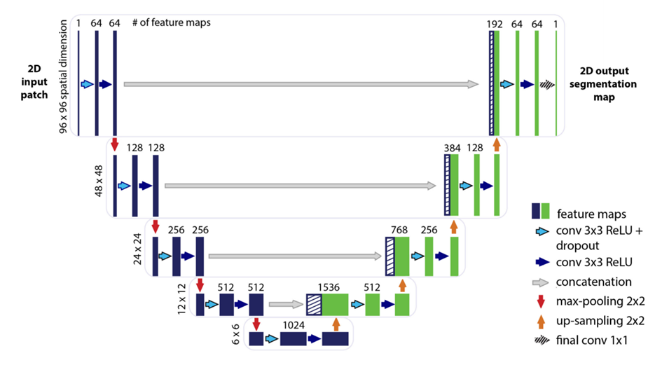 U-NET architecture