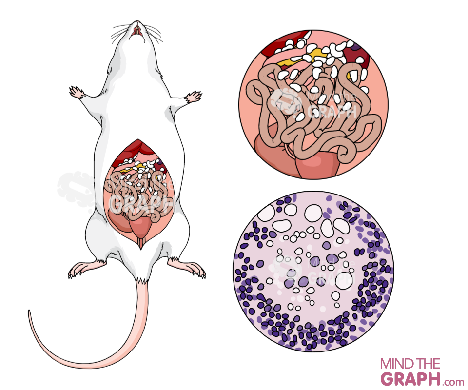 lipogranuloma