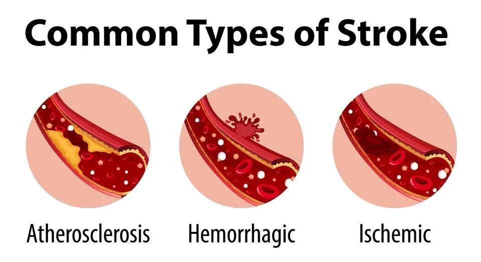 stroke types