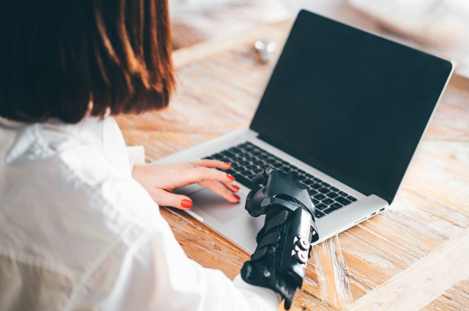 A woman with shoulder-length hair is sitting in front of her laptop. She has a prosthetic arm. The nails in her left hand are painted red. Credit: Canva