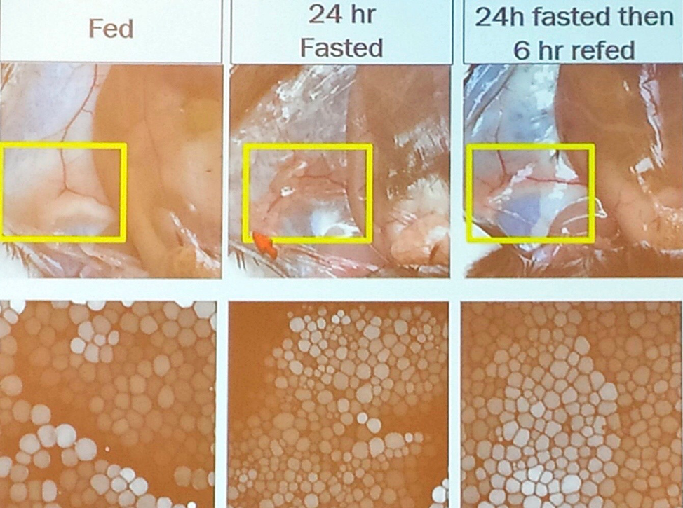 Intermittent fasting helps to store brown fat which is better than white fat