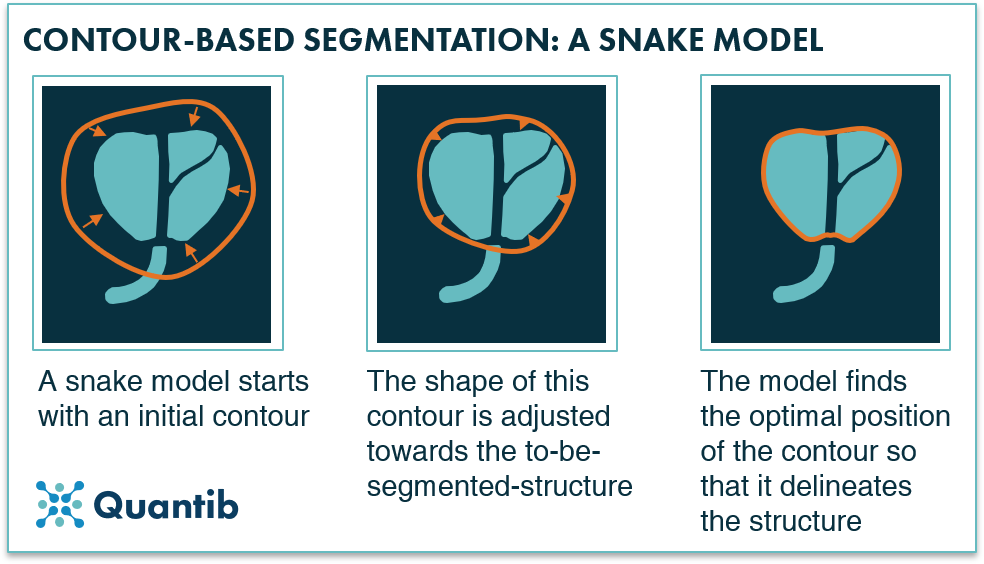 a schematic figure explaining contour-based medical image segmentation