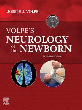 volpes-neurology-of-the-newborn-1904399-1