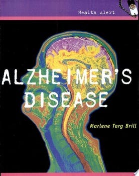 alzheimers-disease-58874-1