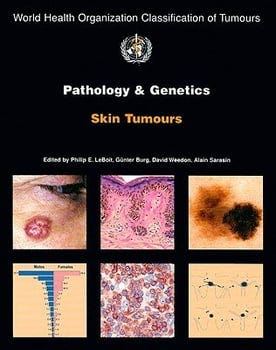 pathology-and-genetics-of-skin-tumours-3257837-1