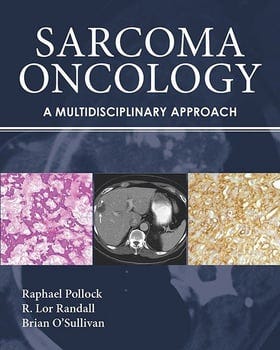 sarcoma-oncology-3039101-1