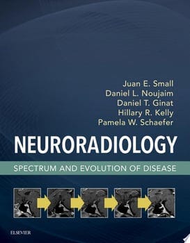 neuroradiology-64026-1