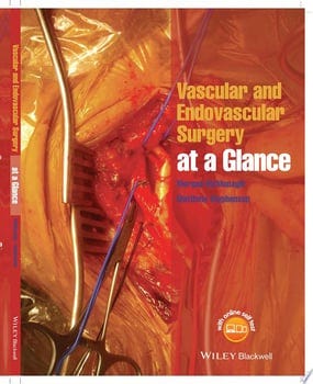 vascular-and-endovascular-surgery-at-a-glance-66670-1
