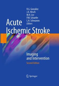 acute-ischemic-stroke-164513-1
