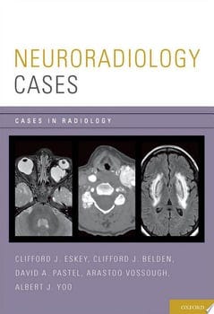 neuroradiology-cases-64025-1