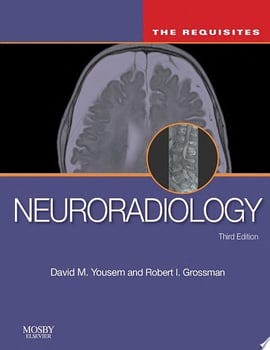 neuroradiology-64020-1