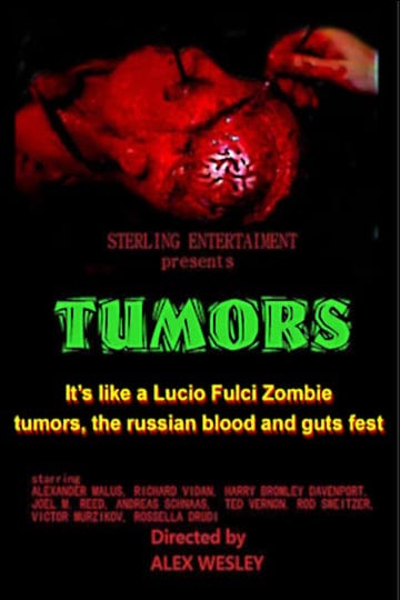 tumors-4766631-1