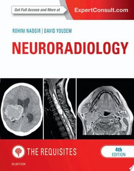 neuroradiology-the-requisites-e-book-64024-1
