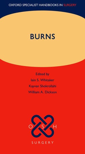 burns-book-1