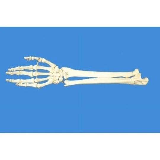 wellden-product-anatomical-human-right-hand-with-ulna-and-radius-skeleton-model-life-size-1