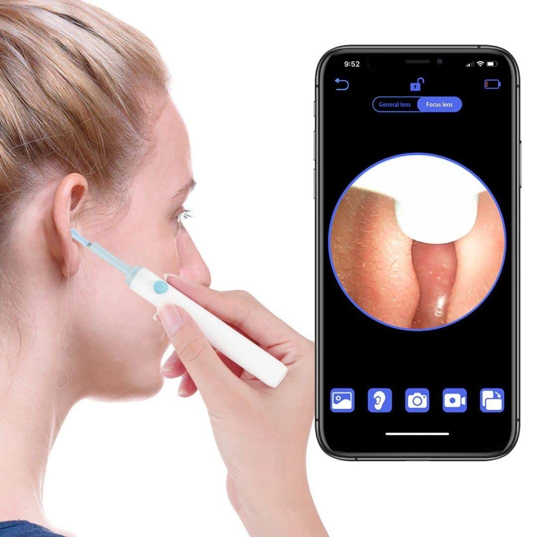 Ear Wax Removal Kit with Camera for Safe and Effective Cleaning | Image