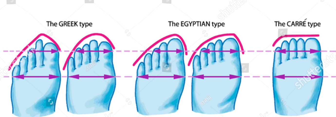 Греческий тип пальцев. Типы стоп по пальцам. Ноги египетского типа. Крестьянский Тип стопы. Греческий Тип ноги.