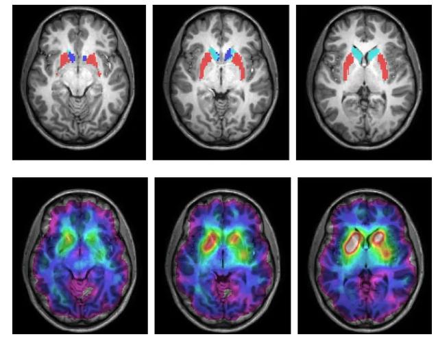 As a Neuroscientist, I Quit These 5 Morning Habits That Were Quietly Destroying My Brain
